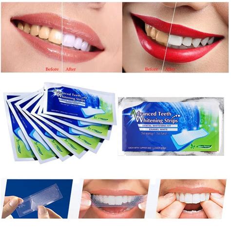 Achieve Professional Results at Home: Soow Magic Whitening Strips